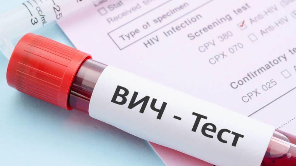 В Казахстане в сентябре выявлено 306 новых носителей ВИЧ-инфекции